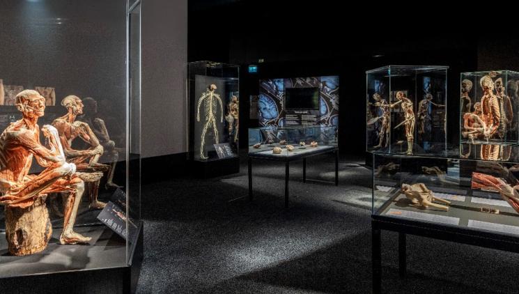 Výstava BODY WORLDS v Praze: vydejte se za tajemstvím dlouhověkosti a zdravého životního stylu